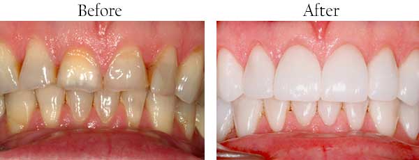 Roslyn Heights dental images