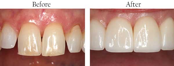 dental images 11577